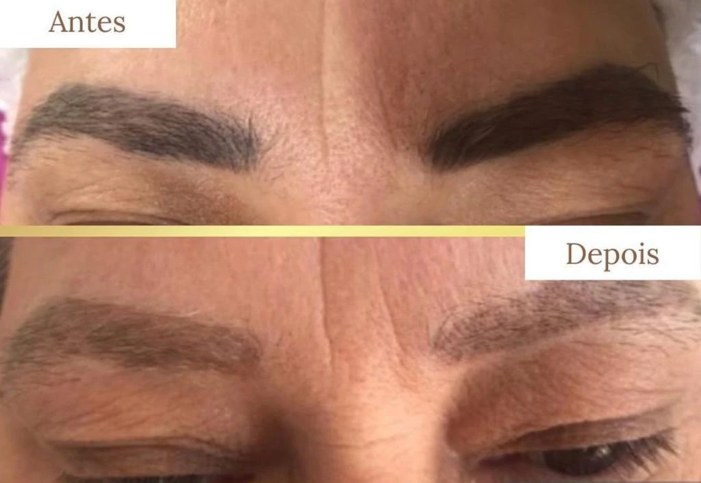Resultado antes e depois 10